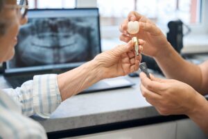 Smile Restoration in North York: Are Dental Implants Worth It?