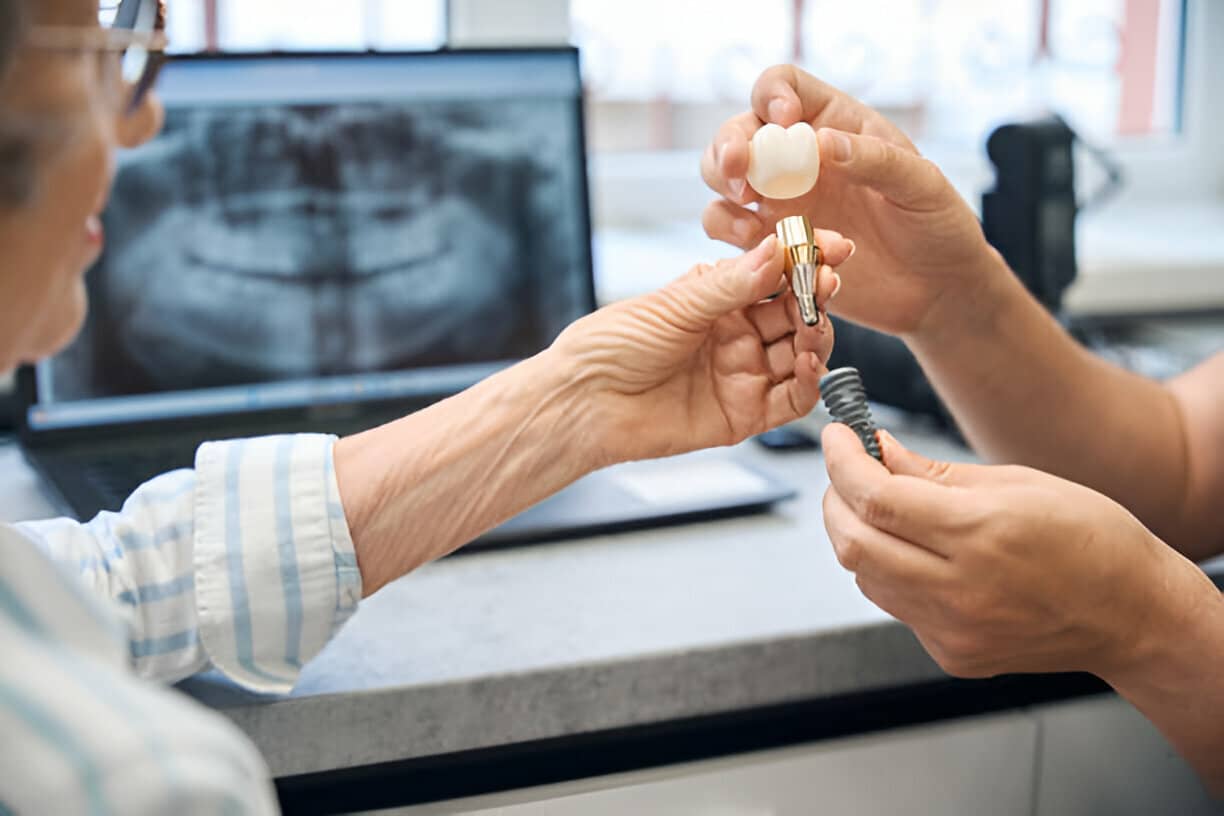 Smile Restoration in North York: Are Dental Implants Worth It?