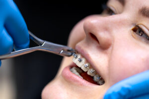 how long does orthodontic treatment take