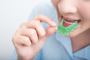 retainer cleaning tips